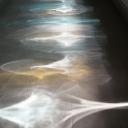 Restauración vidrieras de la Residència de Gent Gran Francesc Layret, antigua Casa de la Lactancia. Barcelona